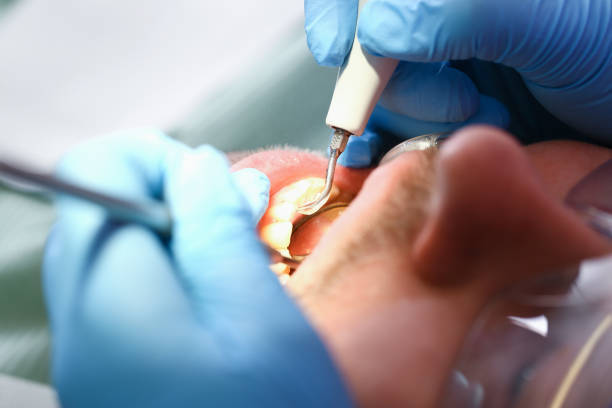Best Urgent Care for Lost Fillings or Crowns in Byron Center, MI