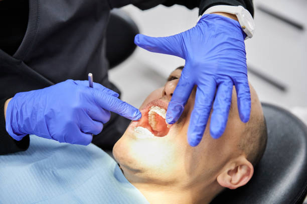 Best Emergency Root Canal Treatment in Byron Center, MI