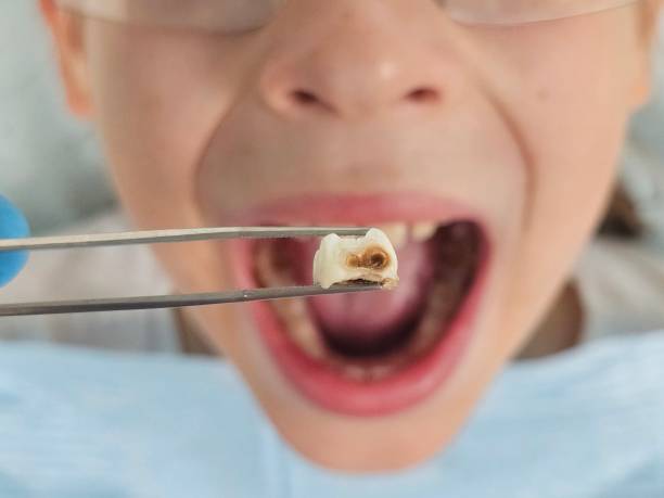 Best Emergency Gum Treatment in Byron Center, MI