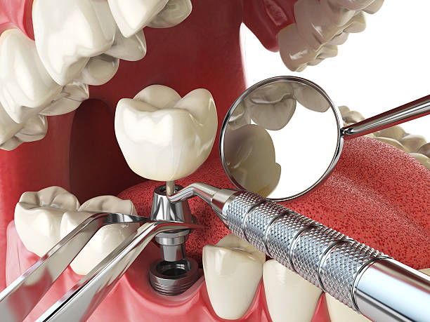 Best Same-Day Emergency Dental Services in Byron Center, MI